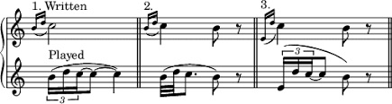 Do you know what an appoggiatura is? It’s a grace note performed before another&nbsp;note.